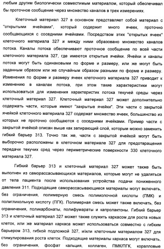 Устройство для лечения путем подкожной подачи пониженного давления с использованием текучей магистрали и связанный с ним способ (патент 2405459)