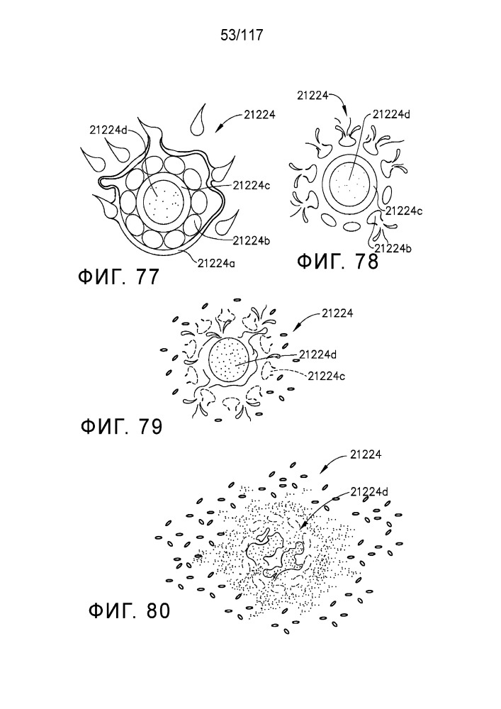 Компенсатор толщины ткани, содержащий множество капсул (патент 2648844)