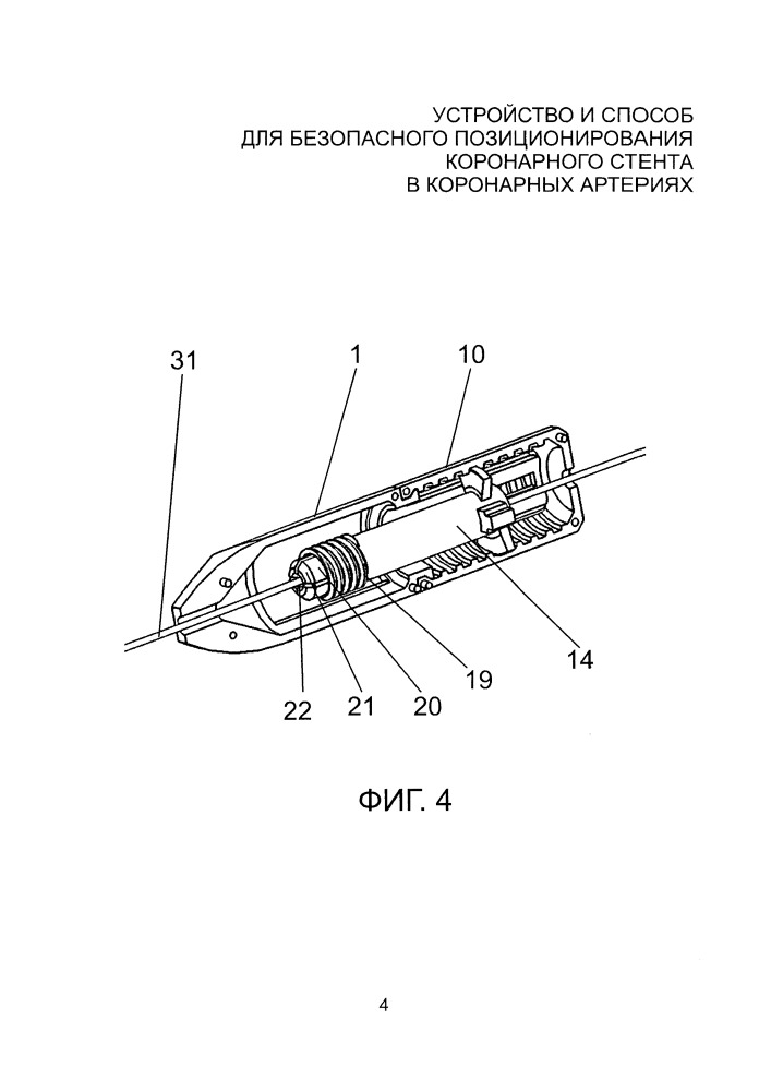 Устройство и способ для безопасного позиционирования коронарного стента в коронарных артериях (патент 2661092)