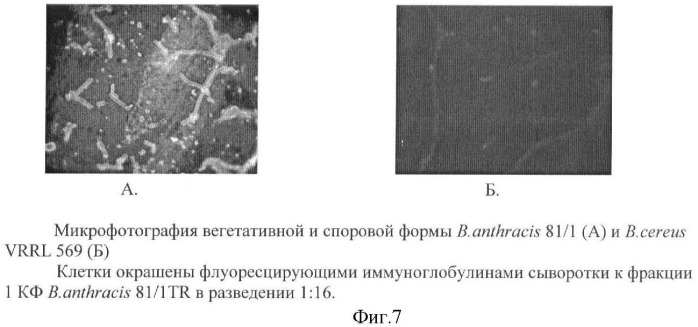 Способ идентификации bacillus anthracis с дифференциацией штаммов по продукции капсулы, протективного антигена и антигенов s-слоя (патент 2376385)