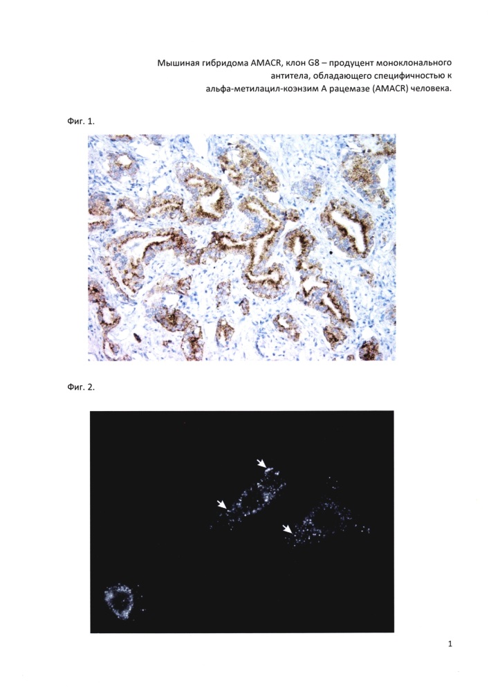 Мышиная гибридома amacr, клон g8 - продуцент моноклонального антитела, обладающего специфичностью к альфа-метилацил-коэнзим a рацемазе (amacr) человека (патент 2636042)