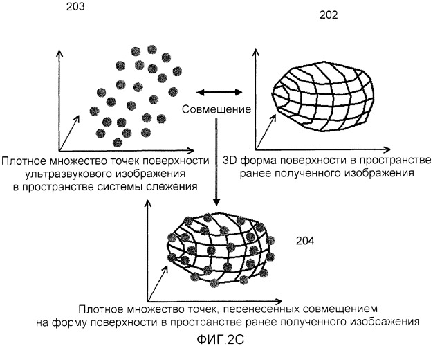 Система и способ для объединения ультразвуковых изображений в реальном времени с ранее полученными медицинскими изображениями (патент 2468436)