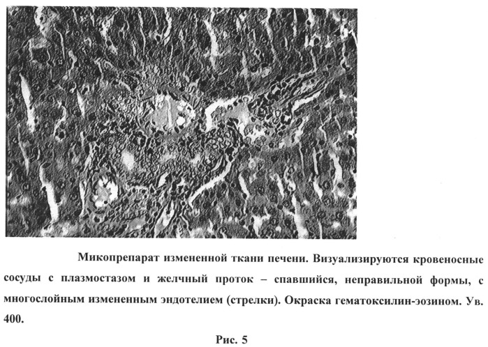 Способ получения метастазов печени в эксперименте (патент 2538243)