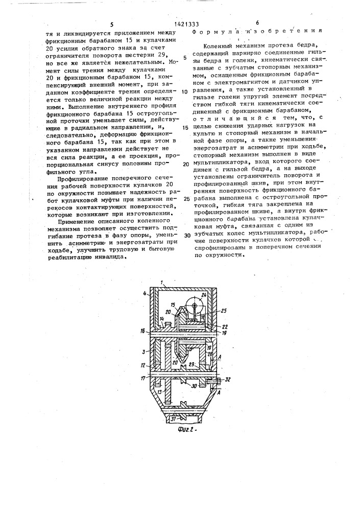 Коленный механизм протеза бедра (патент 1421333)