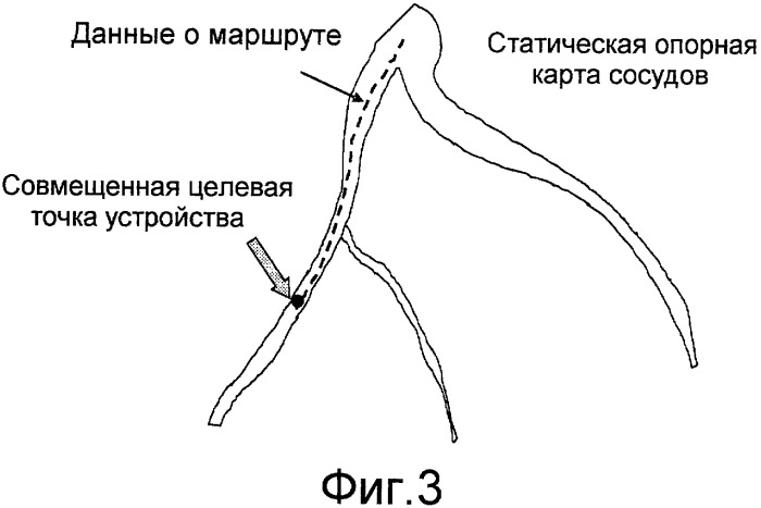 Картирование сердца (патент 2461881)