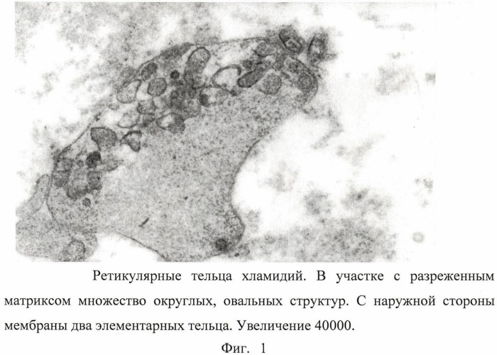 Способ диагностики хламидийной инфекции у хряков-производителей (патент 2490634)