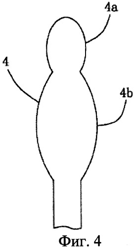 Сшивное устройство для возврата и фиксирования височно-нижнечелюстного суставного диска (патент 2471443)
