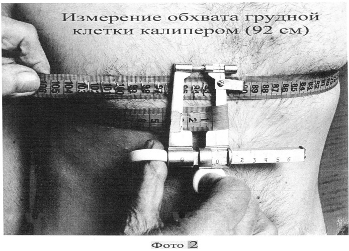 Способ измерения обхвата грудной клетки человека (патент 2500342)