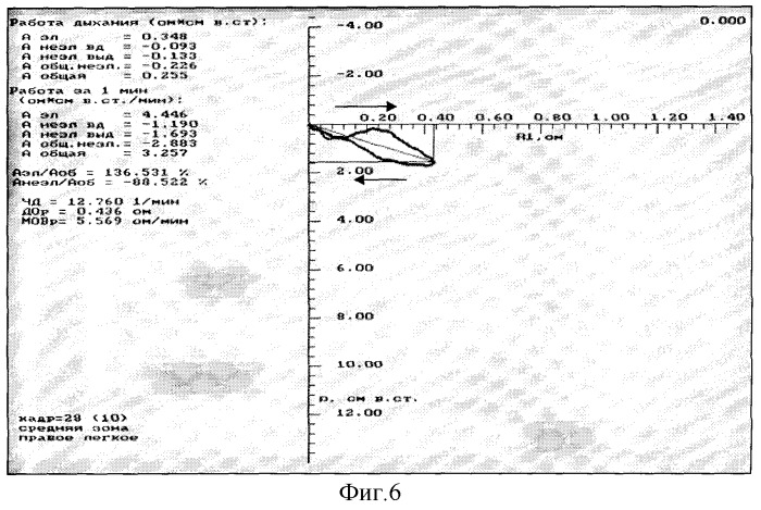 Способ определения регионарной механической активности легких (патент 2328970)