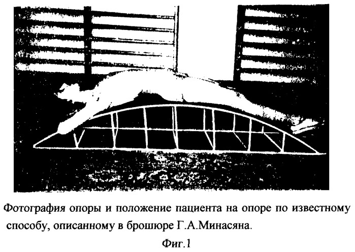 Способ лечения и профилактики заболеваний позвоночника (патент 2252000)
