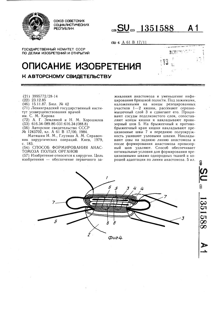 Способ формирования анастомоза полых органов (патент 1351588)