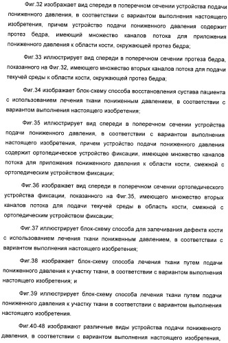 Система и способ продувки устройства пониженного давления во время лечения путем подачи пониженного давления (патент 2404822)