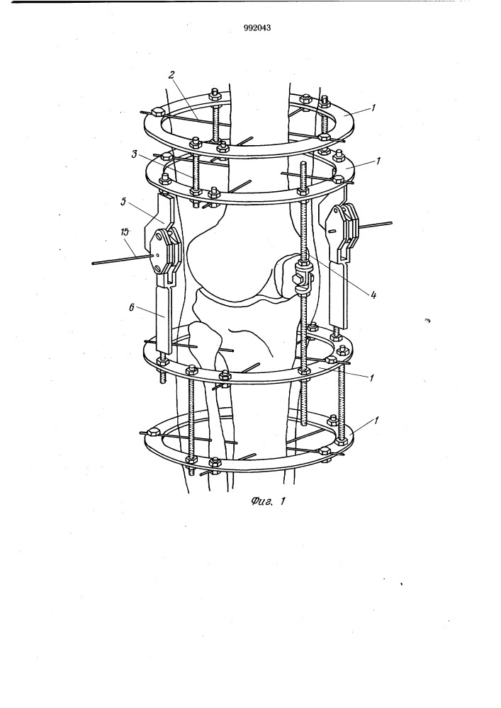 Аппарат для восстановления движений в коленном суставе (патент 992043)