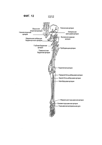 Ангиосомная система контроля кровоснабжения (патент 2587949)