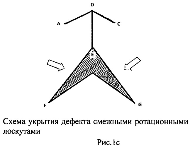 Способ пластического замещения дефектов кожи двумя смежными ротационными лоскутами (патент 2460472)