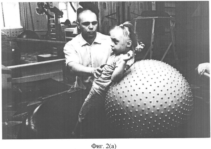 Способ реабилитации детей с болезнями нервной системы (патент 2358707)