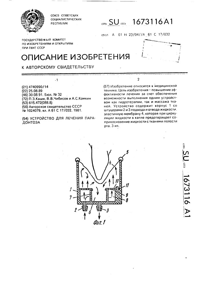 Устройство для лечения парадонтоза (патент 1673116)