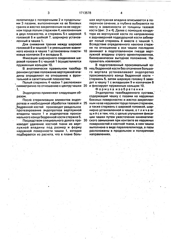 Эндопротез тазобедренного сустава (патент 1713578)
