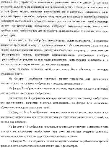 Имплантаты для создания соединений с тканями, в частности со скелетом, а также устройство и способ имплантации (патент 2314768)