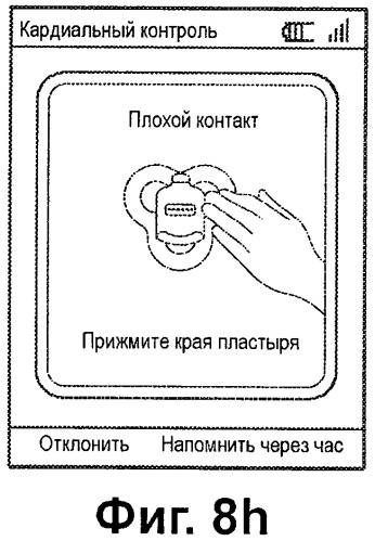 Система контроля экг с конфигурируемыми пределами включения сигналов тревоги (патент 2499550)