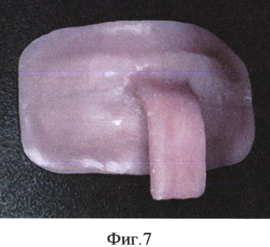 Способ изготовления индивидуальной ложки для снятия оттисков с мягких тканей лица (патент 2648848)