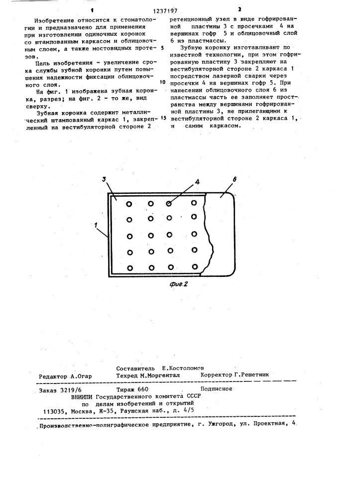 Зубная коронка (патент 1237197)