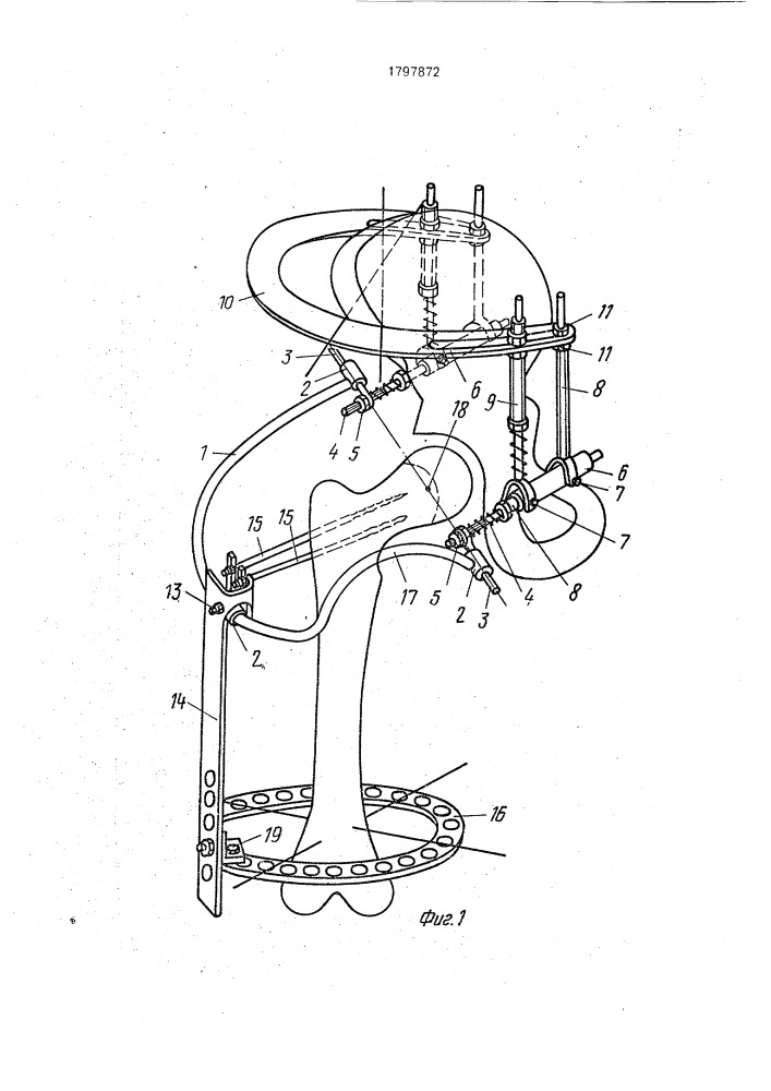 Аппарат для восстановления подвижности тазобедренного сустава (патент 1797872)
