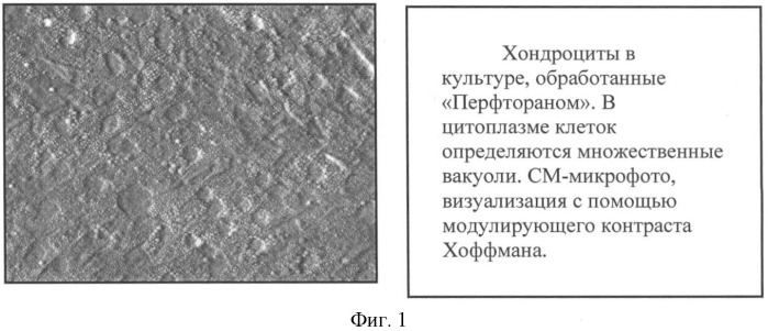 Способ получения донорских хондроцитов (патент 2409662)