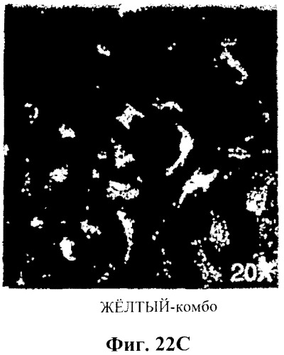 Захват эндотелиальных клеток-предшественников элюирующим лекарственные средства имплантируемым медицинским устройством (патент 2400256)