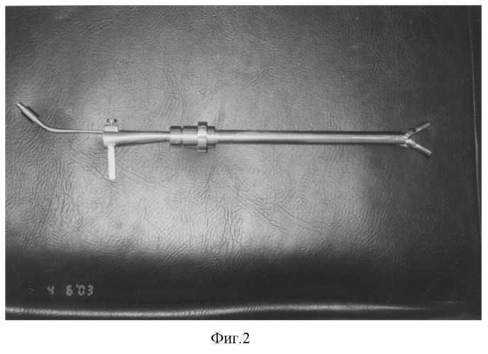Устройство для удаления инородных тел пищевода (патент 2271161)