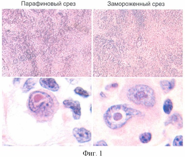 Способ изготовления срезов из свежезамороженной ткани лимфатических узлов (патент 2432575)