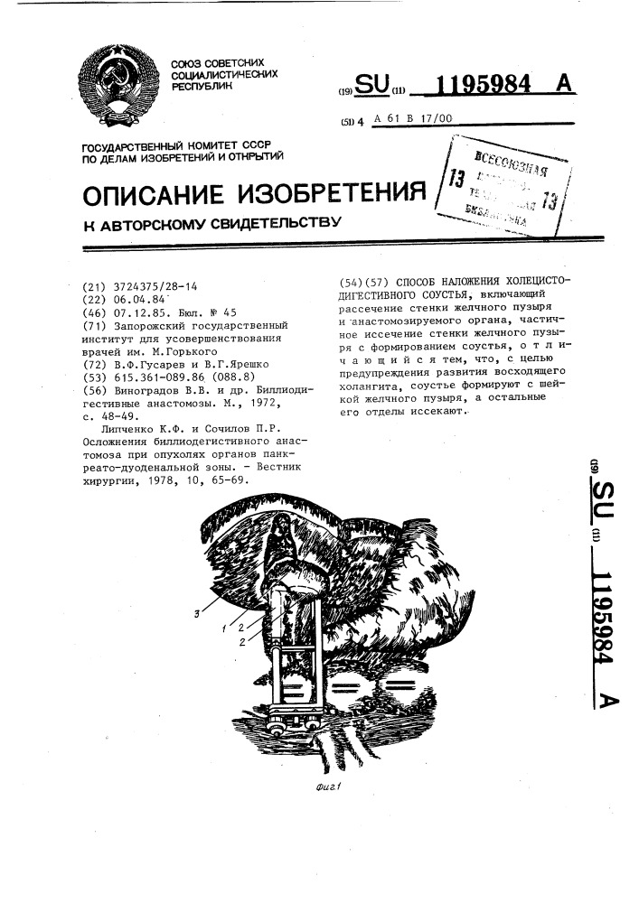 Способ наложения холецисто-дигестивного соустья (патент 1195984)