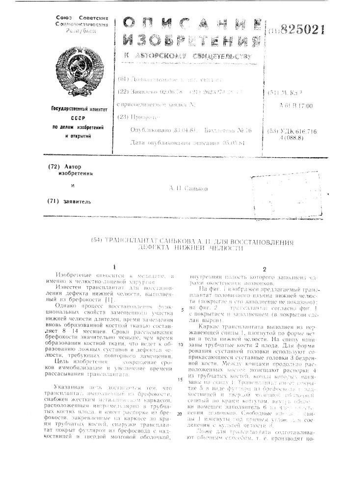 Патент ссср  825021 (патент 825021)