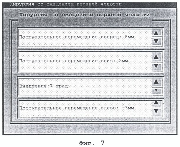 Способ разработки лечебной программы ортогнатической хирургии и соответствующие устройства (патент 2384295)