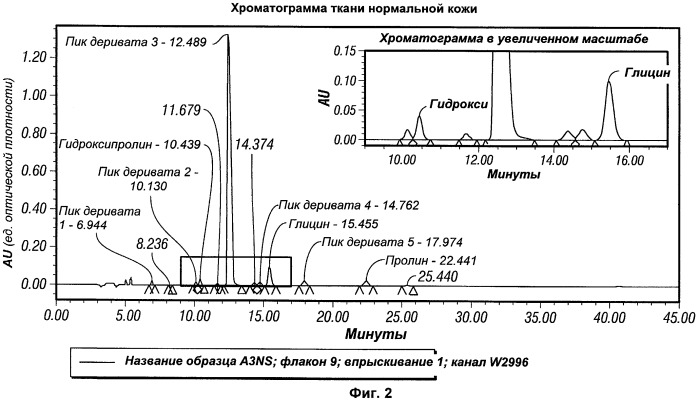 Способ количественного определения коллагена в ткани (патент 2452956)