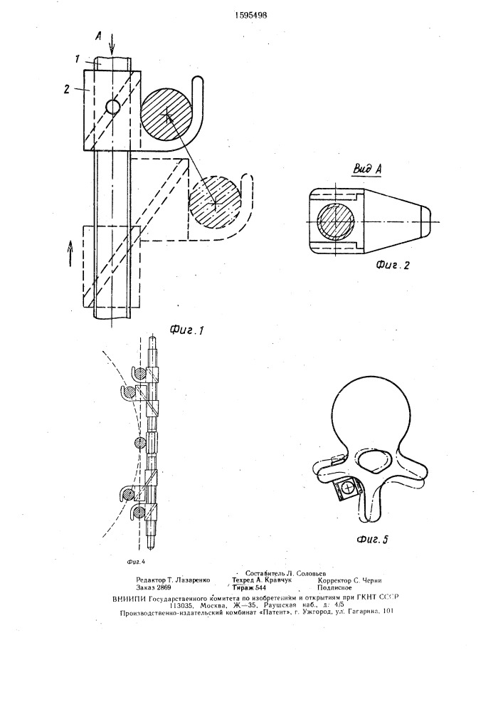 Устройство для коррекции и фиксации позвоночника (патент 1595498)