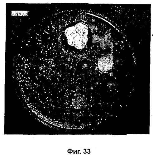 Композиции на основе arthrospira и их применение (патент 2412990)