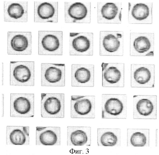 Способ определения уплотненных белково-липидных участков в мембранах эритроцитов различной степени зрелости с помощью компьютерной программы bio vision (патент 2390020)