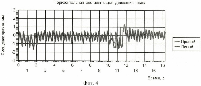 Способ подавления нистагма глаз движущимися полосами (патент 2447865)