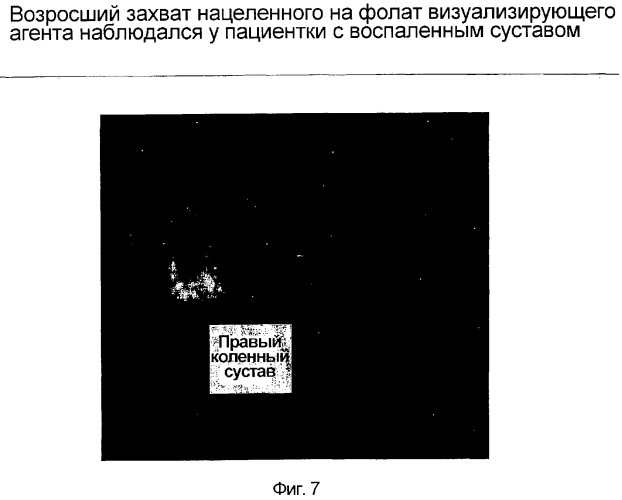 Лечение и диагностика заболеваний, опосредованных макрофагами (патент 2316349)