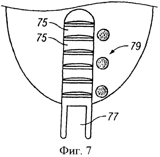 Система подачи пониженного давления, имеющая активируемый вручную насос для обеспечения лечения ран низкой степени тяжести (патент 2417110)