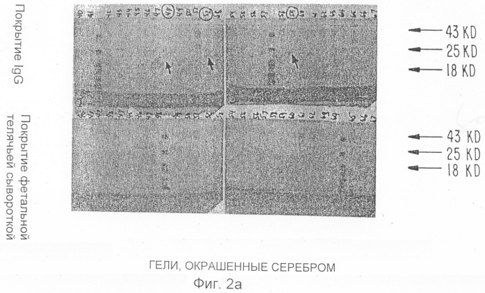 Ингибитор интерлейкина-1, способ его получения, молекула днк, кодирующая ингибитор интерлейкина-1 и его предшественник (патент 2286388)