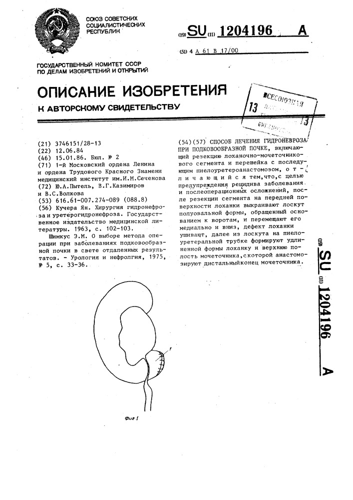 Способ лечения гидроневроза при подковообразной почке (патент 1204196)
