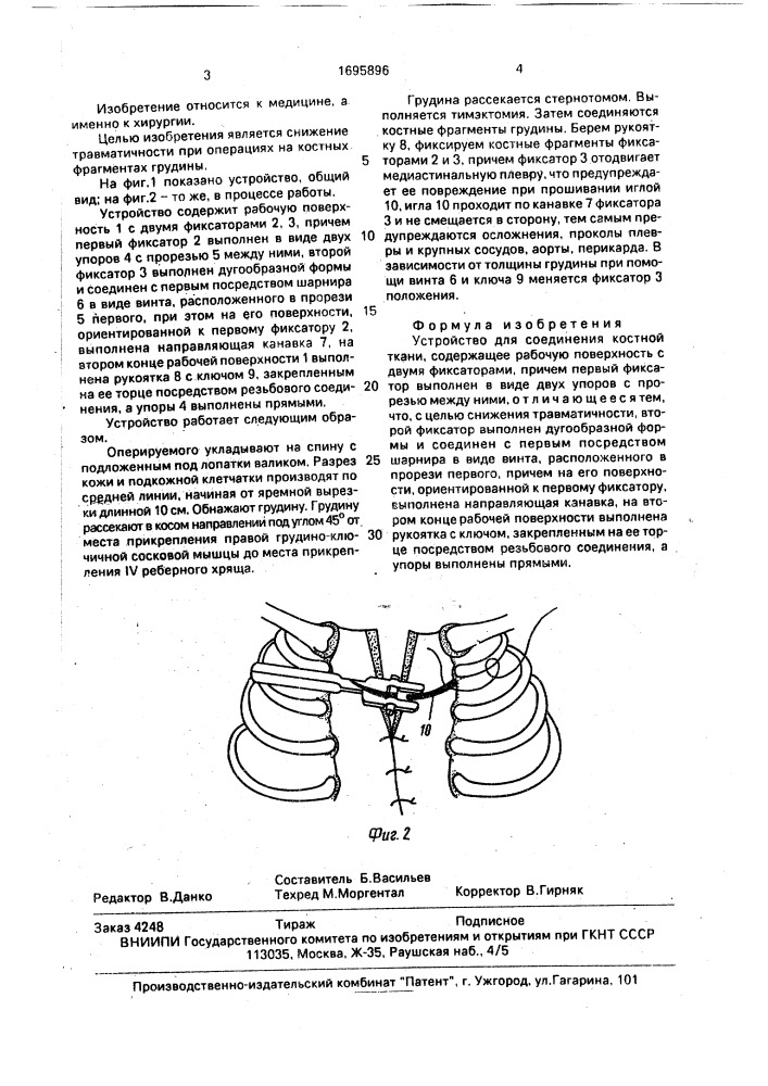 Устройство для соединения костной ткани (патент 1695896)