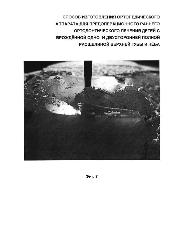 Способ изготовления ортопедического аппарата для предоперационного раннего ортодонтического лечения детей с врождённой одно- и двусторонней полной расщелиной верхней губы и нёба (патент 2599373)