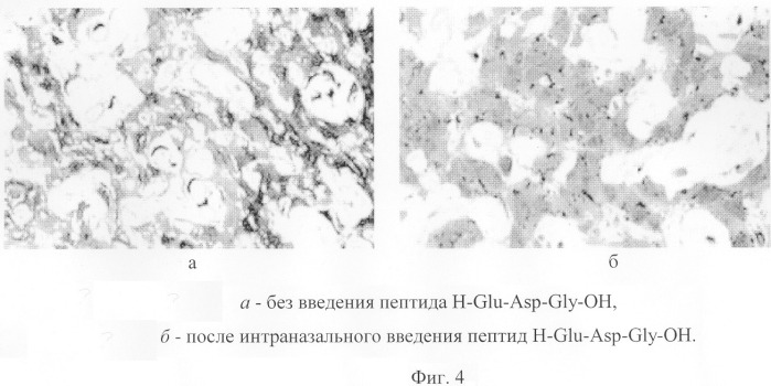 Пептид, обладающий стресспротекторным действием, фармацевтическая композиция на его основе и способ ее применения (патент 2304444)