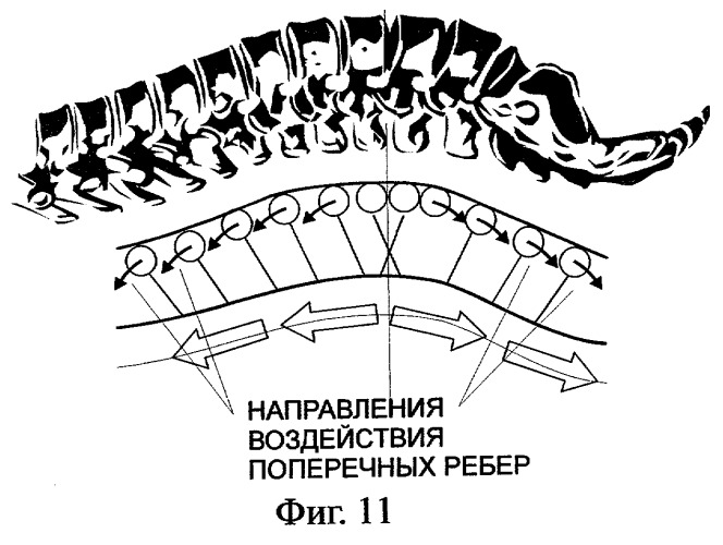 Устройство для коррекции и лечения позвоночника (варианты) (патент 2282431)