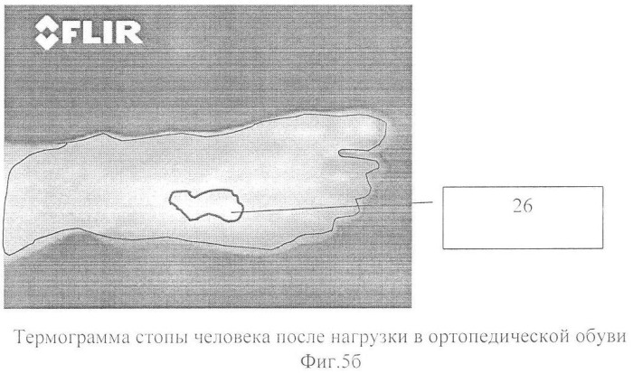 Способ оценки эффективности ортопедической коррекции стопы (патент 2357705)