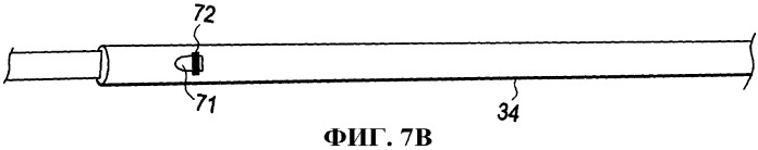Изгибаемый катетер с соединенной центральной стойкой (патент 2563384)