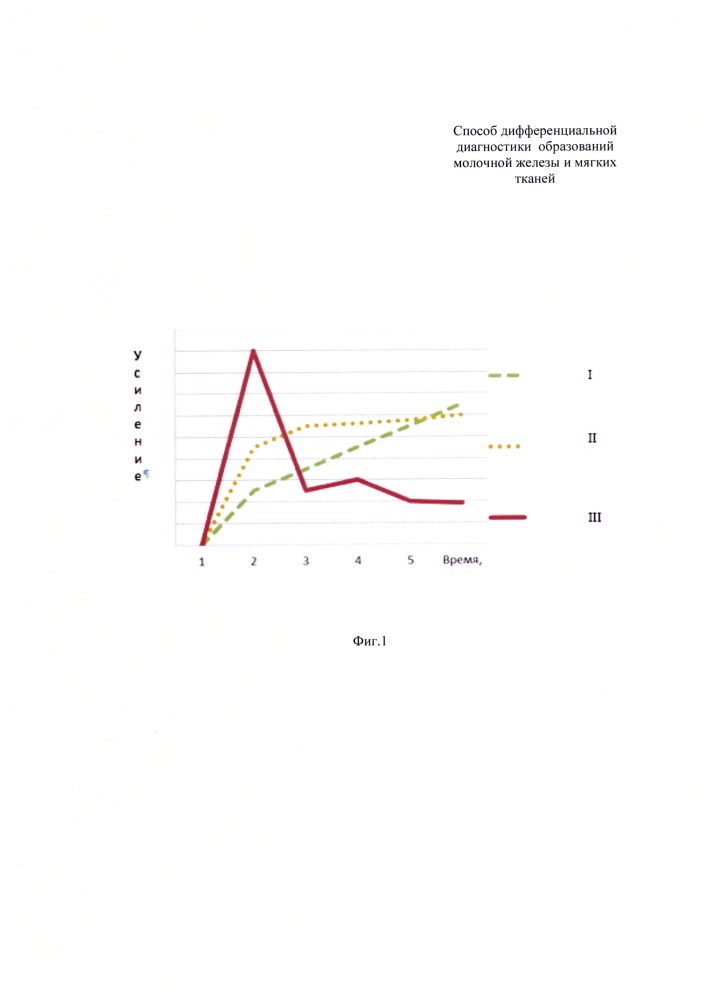 Способ дифференциальной диагностики образований молочной железы и мягких тканей (патент 2634783)